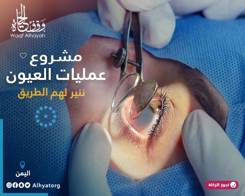 عمليات العيون